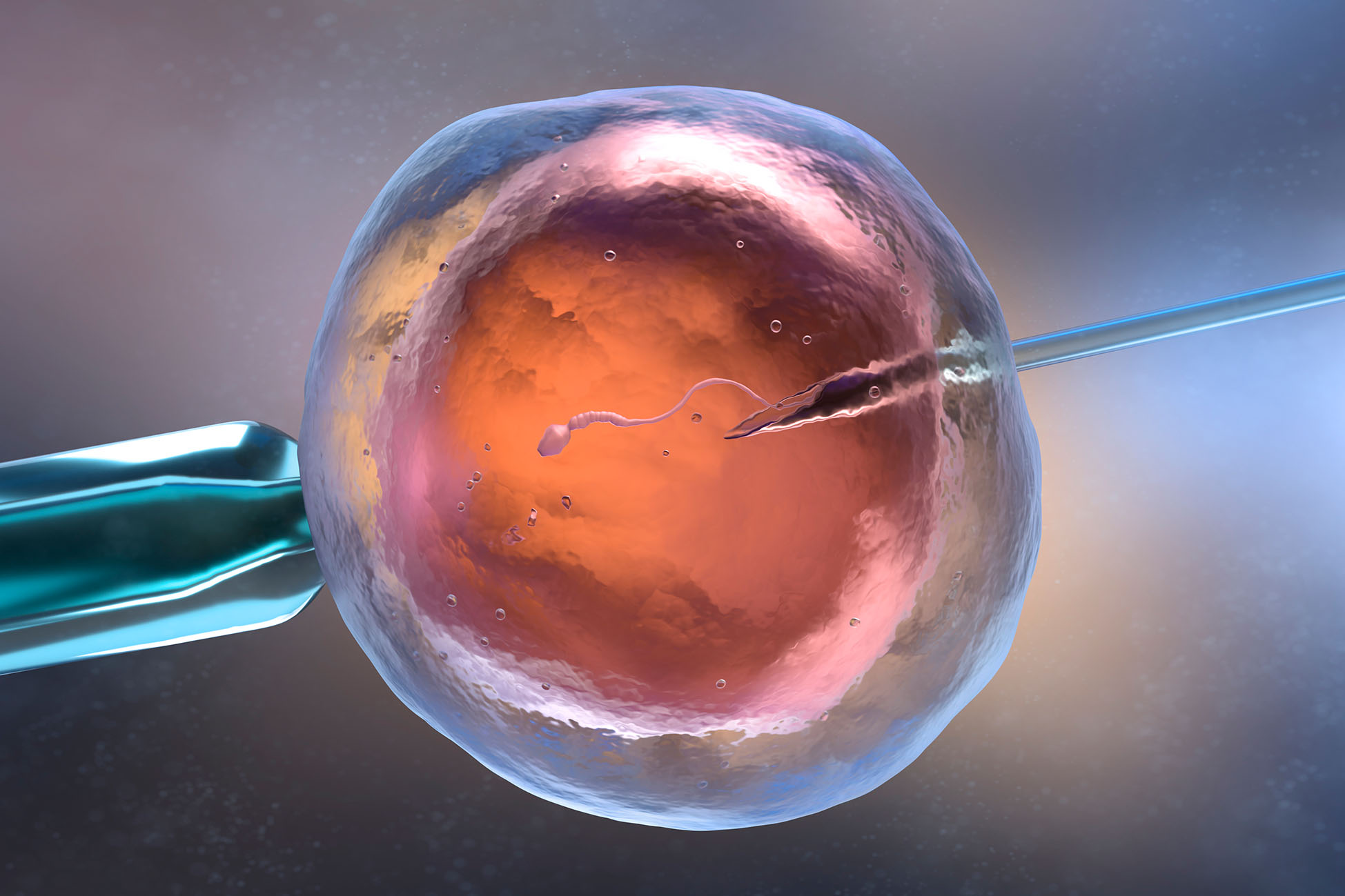 Inseminación artificial. Inserción del espermatozoide en el óvulo.